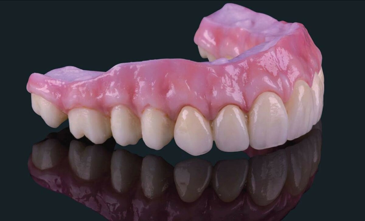 мягкие зубные протезы фото